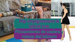 EP 0  Hip impingement and labral tear  Pinzamiento de cadera y rotura del labrum  TRAILER [upl. by Rebeca]