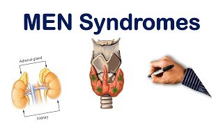 Multiple Endocrine Neoplasia MEN Mnemonic [upl. by Riatsala312]