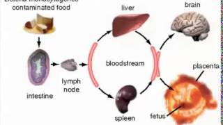 Listeria monocytogenes grampositive rod one cause of meningitis [upl. by Airtened543]