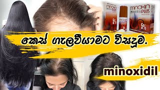 Hair Loss Treatment Sinhala  Sinhala Medical Channel [upl. by Munmro]