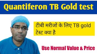 Quantiferon TB Gold test in Hindi  टीबी मरीजों के लिए TB gold टेस्ट क्या है  Result amp Normal value [upl. by Adaner]