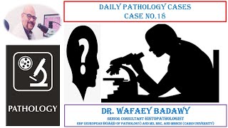 DAILY PATHOLOGY CASES CASE NO 18 BY DR WAFAEY BADAWY [upl. by Akena]