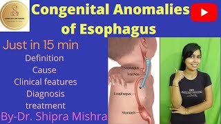 Congenital Anomalies Of Esophagus part1  Tracheoesophageal Fistula Dr Shipra Mishra [upl. by Thorn]