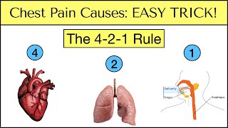 Causes of Chest Pain EASY TRICK to Never Miss an Emergency Must See [upl. by Adile677]