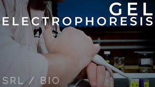 SRL  BIO Gel Electrophoresis A Level  IB Biology [upl. by Nuncia]