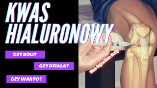 Kwas Hialuronowy moje doświadczenia Czy boli Czy warto [upl. by Edylc976]