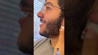 Pimple popping  pimple blackheads amp blackheads treatment [upl. by Thunell]