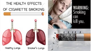 Effects of smoking on the body  How Smoking Kills  Dr Samar Asim  Pulmonologist Lung Specialist [upl. by Nasus853]