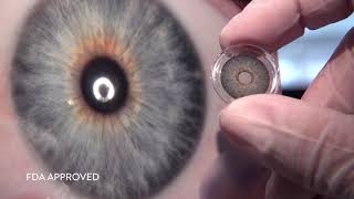 Can HumanOptics change “Human optics history” with its artificial iris [upl. by Malina]