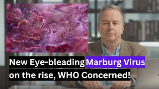 Marburg Virus on the risa [upl. by Aicats]