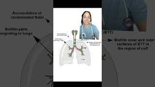 TIP OF THE WEEK auscultating for ETT placement 🩺 [upl. by Sliwa]