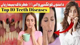 Top 10 Tooth Diseases  Causes of Tooth Diseases  Sensitivity factsart [upl. by Kalk]