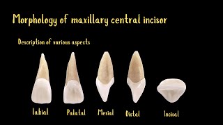 Morphology of maxillary central incisor [upl. by Lorre]