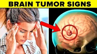 9 Warning Signs Of A Brain Tumor IMPORTANT [upl. by Kokaras]