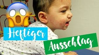 HEFTIGER AUSSCHLAG Everyday life Familienvlog  Filiz [upl. by Clemmy]