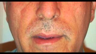 Time Lapse Moustache Growth [upl. by Wales]