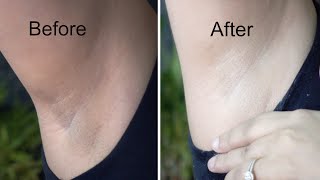 Whiten Dark Underarms in 20 Minutes  Whitening Cream Bleach  Demonstration [upl. by Anderegg487]