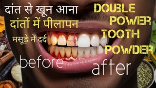 teeth problem double power tooth powder ayurvedColgate tooth powderdouble power tooth affzanish [upl. by Brander]