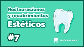 Módulo 7  Restauraciones y recubrimientos Estéticos  Grado Superior Prótesis Dentales [upl. by Wadesworth]