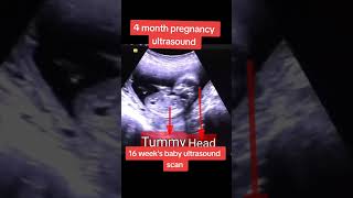 Fetal Heart beat monitoring on ultrasound baby ultrasound abdomen pregnant [upl. by Anatola456]