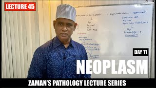 General Pathology Lecture 45  Neoplasm  Day 11 [upl. by Trey]