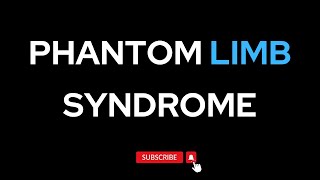 Phantom Limb Syndrome [upl. by Hadihahs]