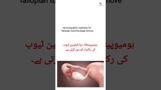 homoeopathic medicine for fallopian tubes blockage remove [upl. by Aldarcie]