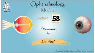 58 Retina 5 Hypertensive Retinopathy Dr Wael Ophthalmology [upl. by Alakim]