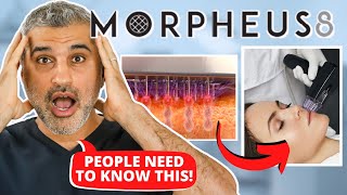 Plastic Surgeon Reveals the REAL TRUTH about Morpheus 8 [upl. by Konyn]