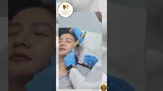 Jaw Botox Procedure [upl. by Oinota]