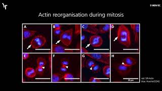 SYNENTEC  Highcontent Imaging of the Actin Cytoskeleton using SiRActin and CELLAVISTA® [upl. by Onitnas]