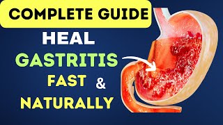 A Complete Guide to Heal Gastritis Fast and Naturally  Gastritis Relief [upl. by Niamrej]