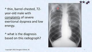 Chronic Bronchitis  Asthma  Emphysema The COPD Triad [upl. by Aihsotal]