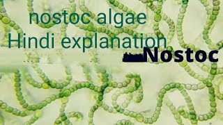 Nostoc algae hindi explanation thallus  cell reproduction botany bsc1semestermsc cynobacteria [upl. by Neved]