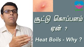 சூட்டு கொப்பளம் ஏன்   Heat Boils  Why  தமிழ் [upl. by Yarrum474]