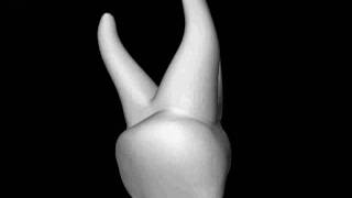 Primary teeth  maxillary first molar [upl. by Mychal]