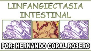 LINFANGIECTASIA INTESTINAL [upl. by Oluas472]