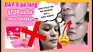 ROSMAR KAGAYAKU REJUVENATING SET  PRODUCT REVIEW  Miss Bessie [upl. by Malchus971]