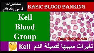 Lecture 51 Kell Blood Group System [upl. by Sheldon]