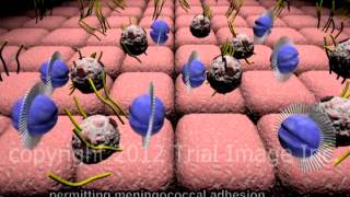 Bacterial Meningitis  fulminant  video  Animation by Cal Shipley MD [upl. by Norda]