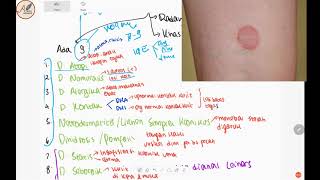 9 Jenis Dermatitis  Review Singkat Klasifikasi Dermatitis [upl. by Bibby73]