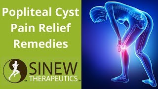 Popliteal Cyst Pain Relief Remedies [upl. by Lewis]