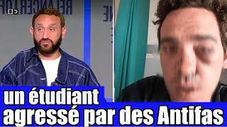 Un étudiant Agressé par des Antifas dans son université 😡 le Tshirt anti J  UIF 🤦‍ TPMP réaction [upl. by Palladin]