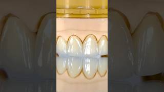 Perfect Anterior Zirconia Restoration EnvisiontecMain envisiontec lsk121shorts dentist [upl. by Almap74]