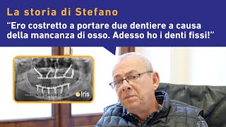 IMPIANTI ZIGOMATICI La Testimonianza della Rinascita di Stefano [upl. by Eelarual]