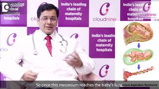 What is Meconium and why babies pass it before birth I Dr Piyush Jain I Cloudnine Hospital [upl. by Fenella]