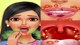 ASMR Cause of bad breath Tonsil stone removal animation [upl. by Novia]