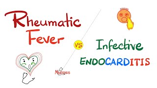 Rheumatic Fever vs Infective Endocarditis  Comparison  Cardiology Series [upl. by Willdon269]