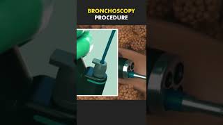 bronchoscopy procedure bscnursing ytshorts medicalstudent doctor lungs nursing [upl. by Yliab]