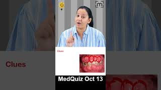 MedQuiz 13 Oct [upl. by Dollie231]